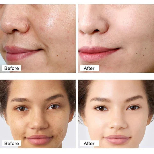 Retinol Cream Skin Lightening Anti Wrinkl